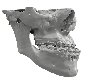 ENT Head Neck 3D Model