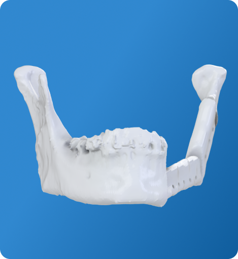 3D Printed Jaw Model
