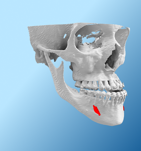 3D Printed Skull Model