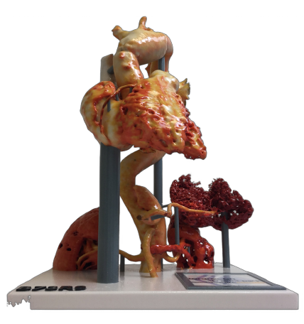 Asthi anatomical model