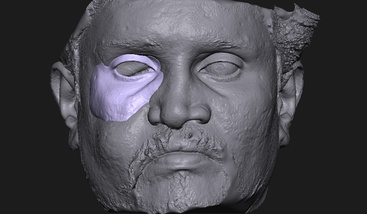 Facial Prosthesis Package