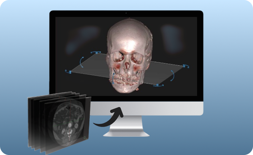 Medical Image Segmentation