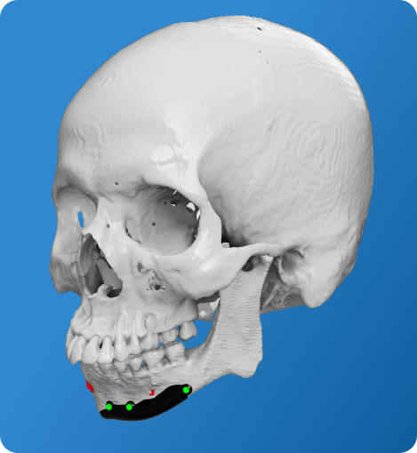 3D Printed Cranial Model