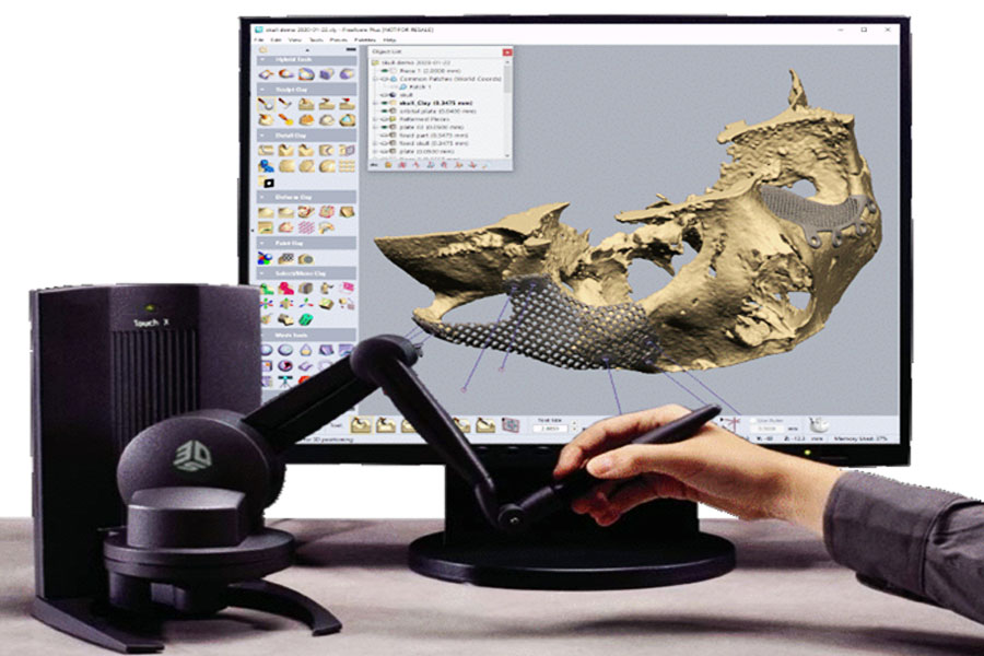 3D Scanning of Human Face