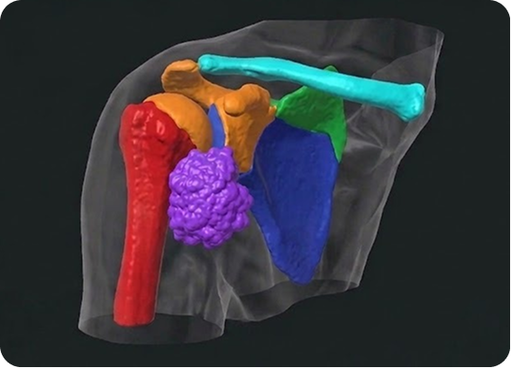 Oncology