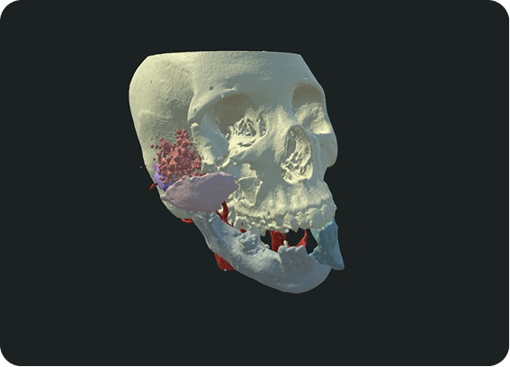 Maxillofacial Surgery
