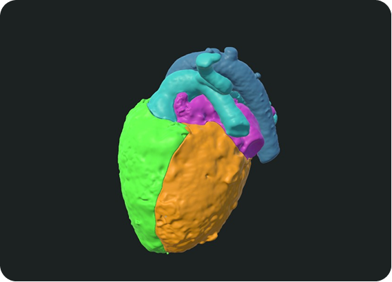 Cardiac Surgery