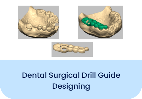 Dental Prosthetics