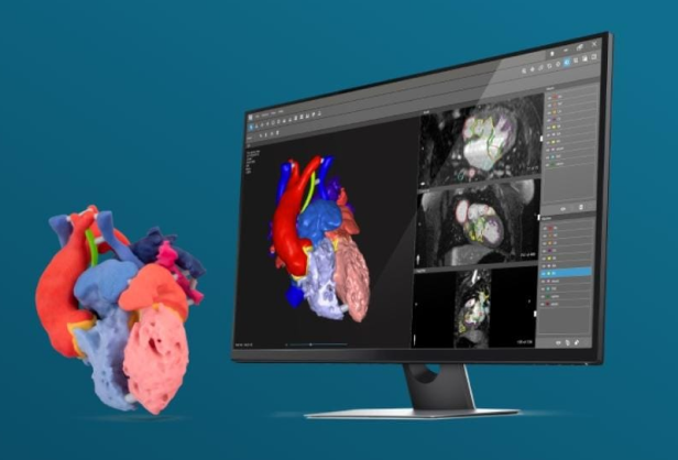 DICOM to 3D conversion service