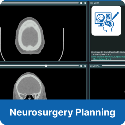 Neurosurgery Planning