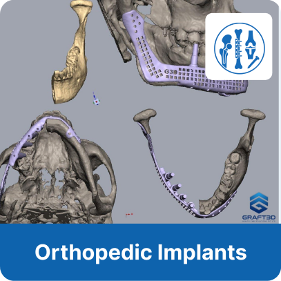 Orthopedic Implants