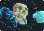 3D skull model visualization