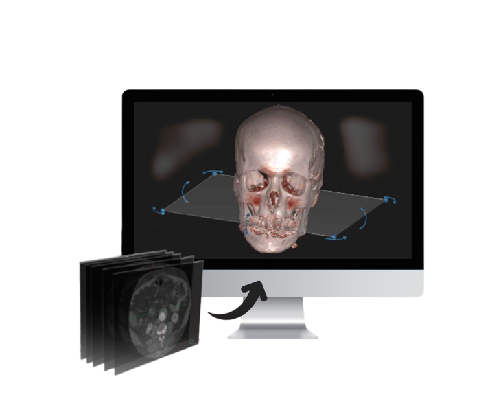 Medical CT scans converted into an accurate 3D anatomical model on screen