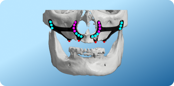 Exceptional Accuracy