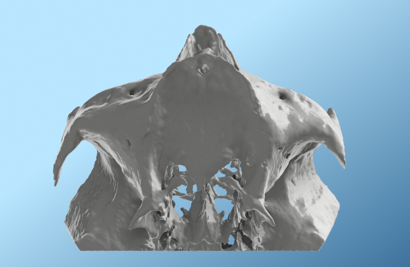 Reduced Donor Site Morbidity