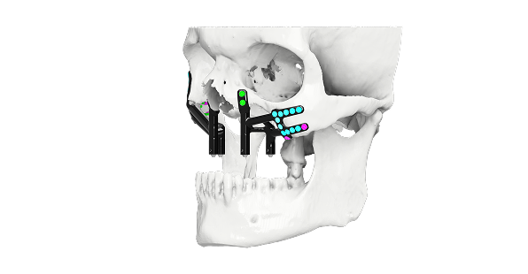 Infective Pathologies Maxilla PSI
