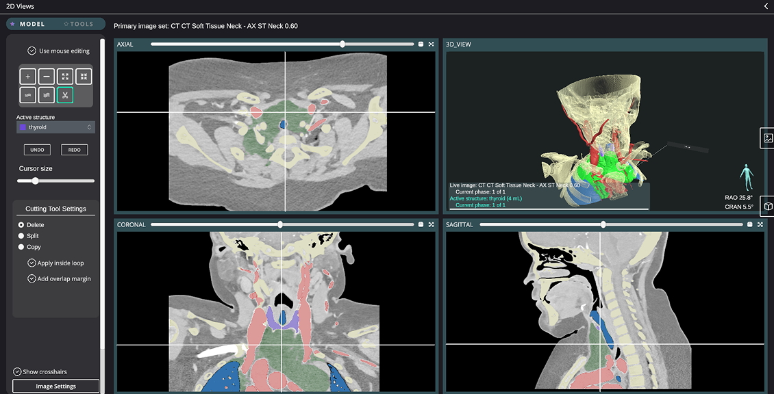 Surgical Planning