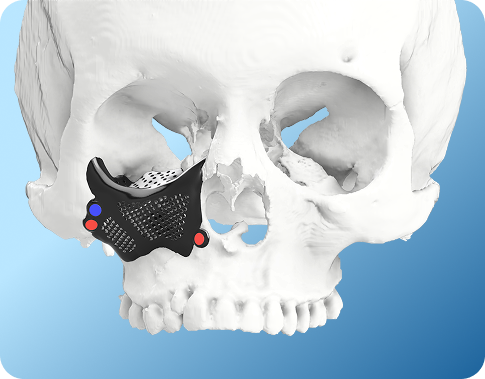 Virtual Surgical Planning Overview