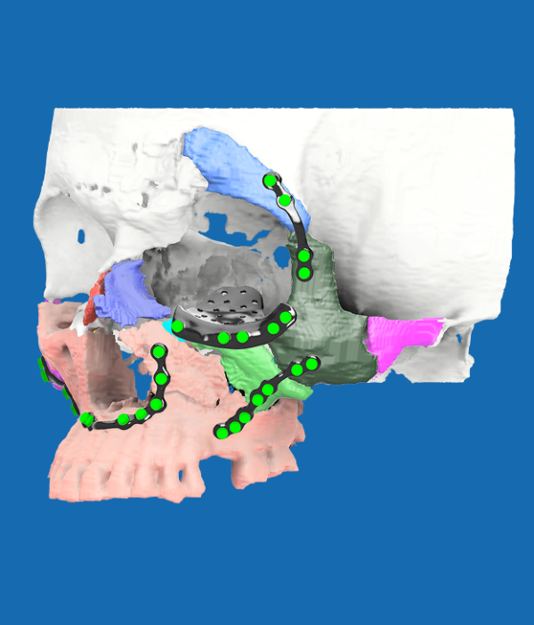 Facial Trauma Management Model