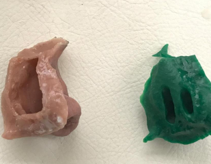 Geomagic Phantom Haptic Devices Allow Surgeons to Practice Procedures Using Virtual Touch