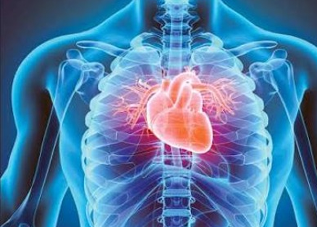Cardiac surgery