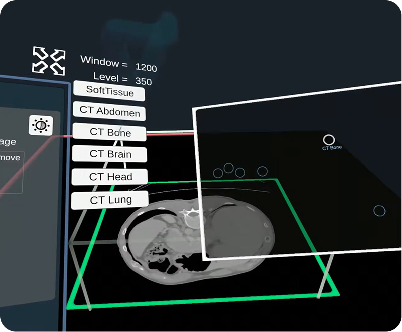 Import DICOM Data