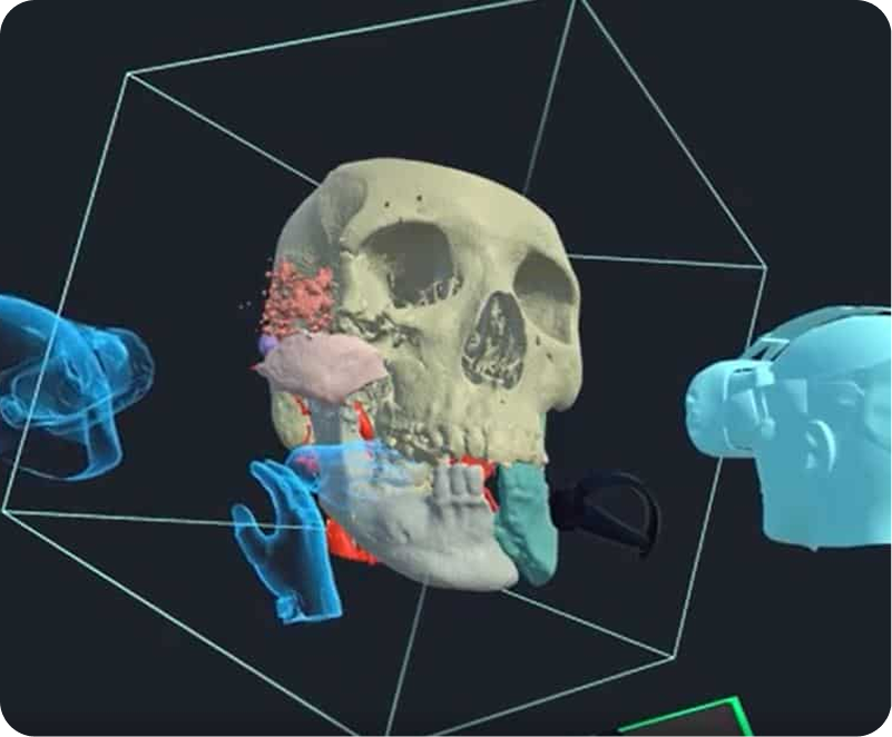 Create Patient-Specific Anatomy