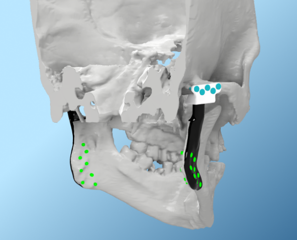 Advantages of a Digital Workflow