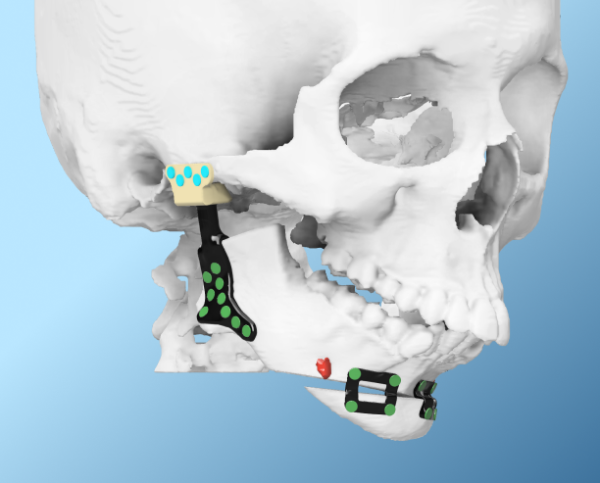 Advantages of a Digital Workflow