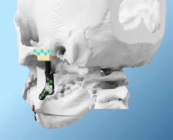 Advantages of a Digital Workflow