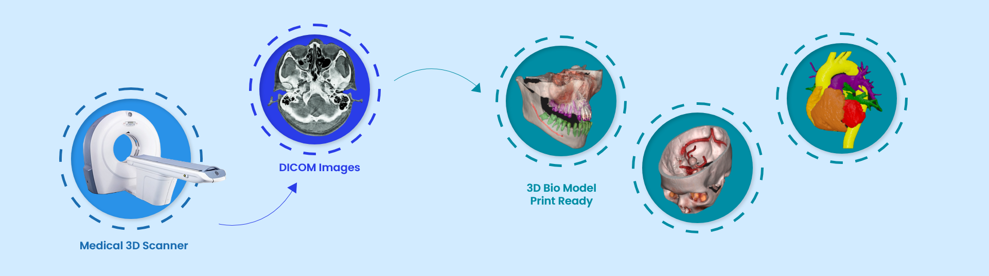 Medical 3D Scanner → DICOM Images → 3D Bio Model Print Ready