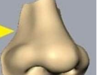 Close-up of 3D designed nasal prosthesis