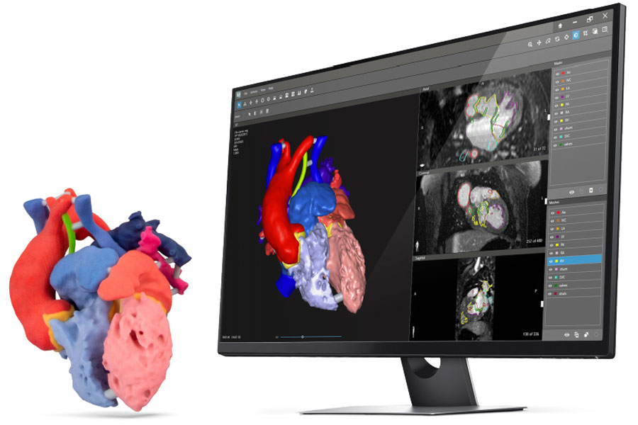 D2P – Bone , Vascular , Teeth