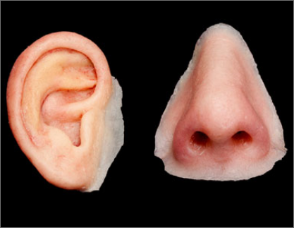 Artificial Nose & Ears