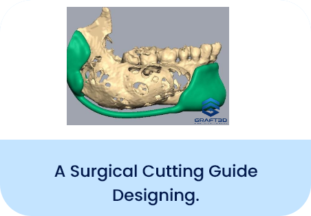 Surgical Cutting Guides designing