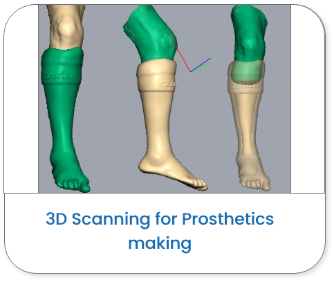 Leg Prosthetics design in Freeform