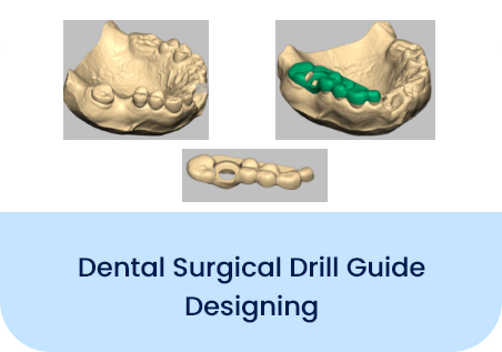 Dental Surgical Drill guide Designing