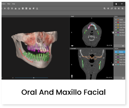 Oral and maxillo facial