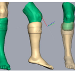 Ankle foot orthotics