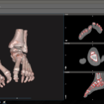 Orthopedics Ankle