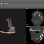 Oral and Maxillofacial