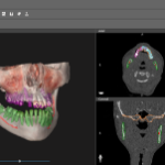 Oral and Maxillofacial