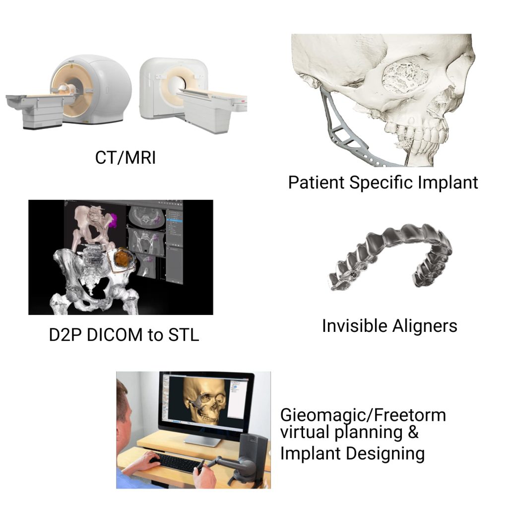 Patient specific Implant