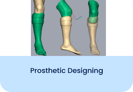 Prosthetic Designing