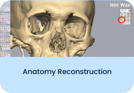 Anatomy Reconstruction