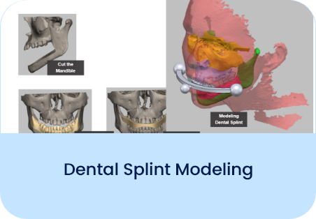 Dental Splint Modelling