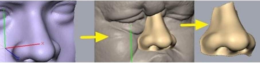 Facial prosthesis in India